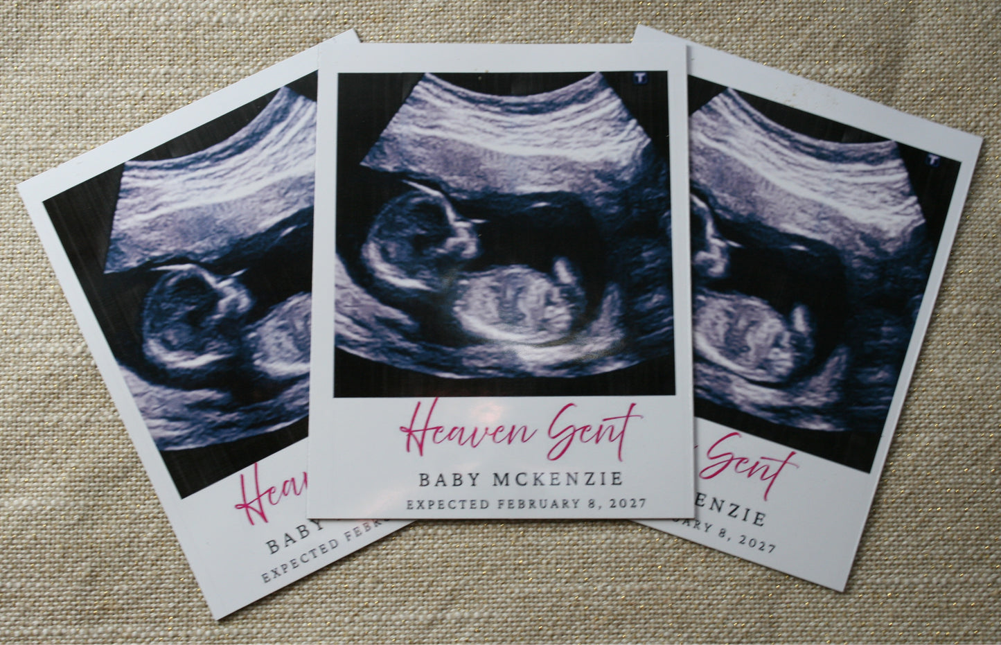 Ultrasound Baby Announcement 3.25 x 4 Magnets