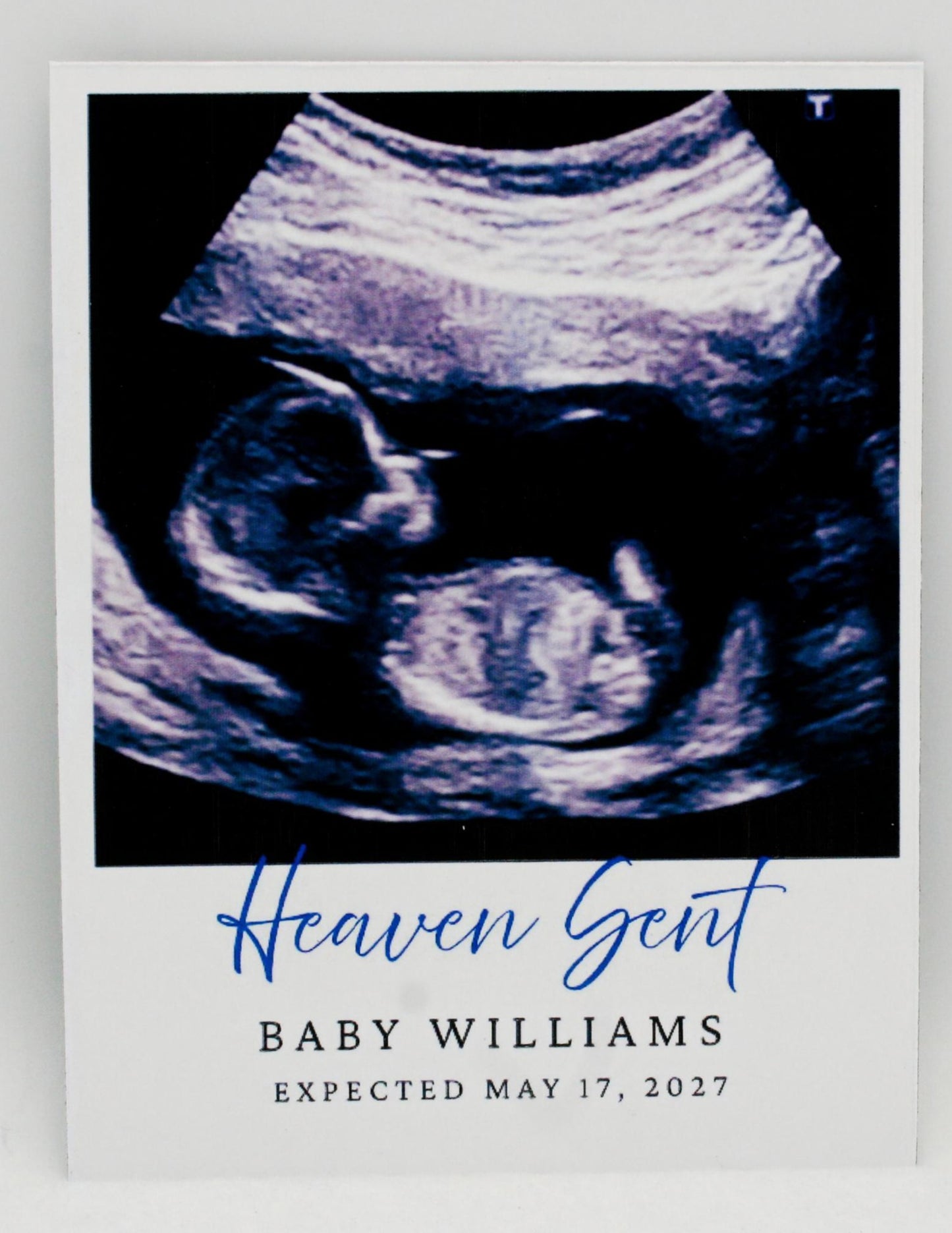 Ultrasound Baby Announcement 3.25 x 4 Magnets